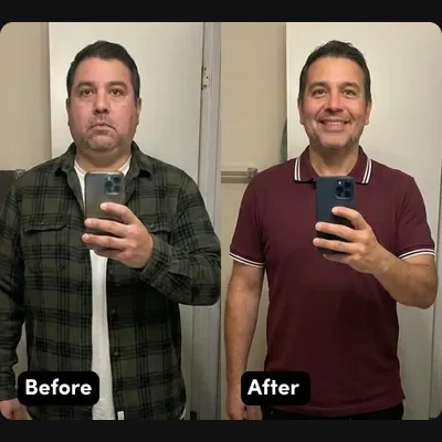 Roberto — before and after Hume Care, 61.7 lbs lost in 12 months